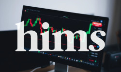 Beitragsbild zu Hims & Hers Aktie: Führungswechsel vor Zahlen